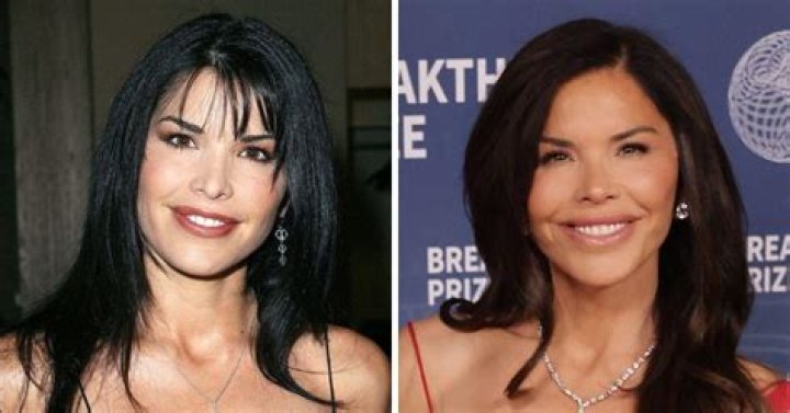 Amirahdyme Plastic Surgery | Before And After Photos