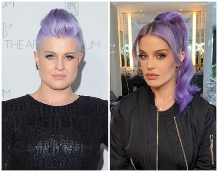 Kelly Osbourne Before And After Plastic Surgery, Age And Husband
